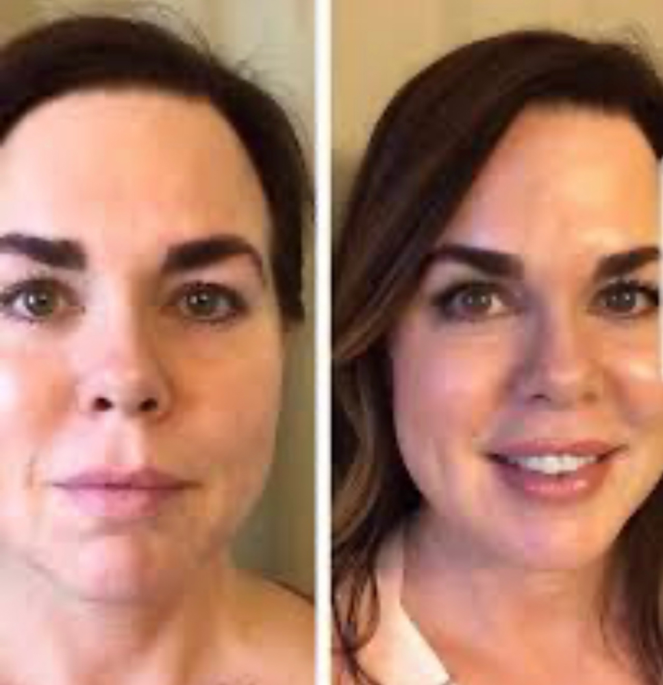 C-Esta Facial W/LED & Dermaplanning