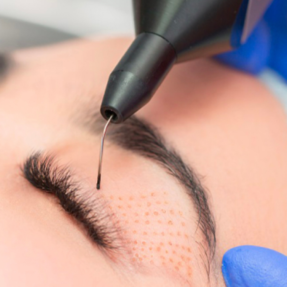Fibroblast at marisol makeup in Denver, CO