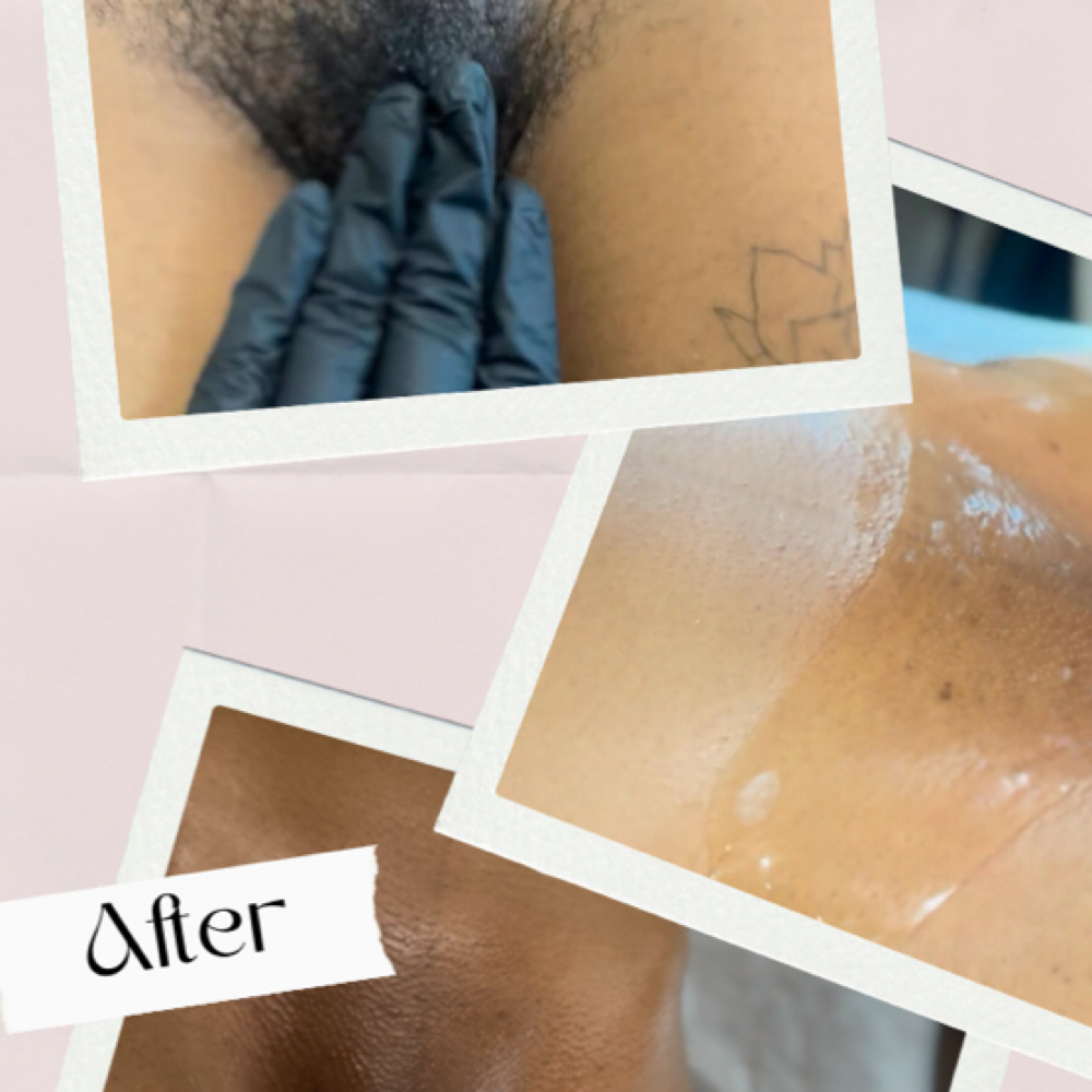 Brazilian + Intimte Facial (Women) at Bare RX + Wellness | Full Body Waxing in Midtown Houston in Houston, TX