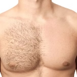 Chest to Impress [Full Chest Wax]