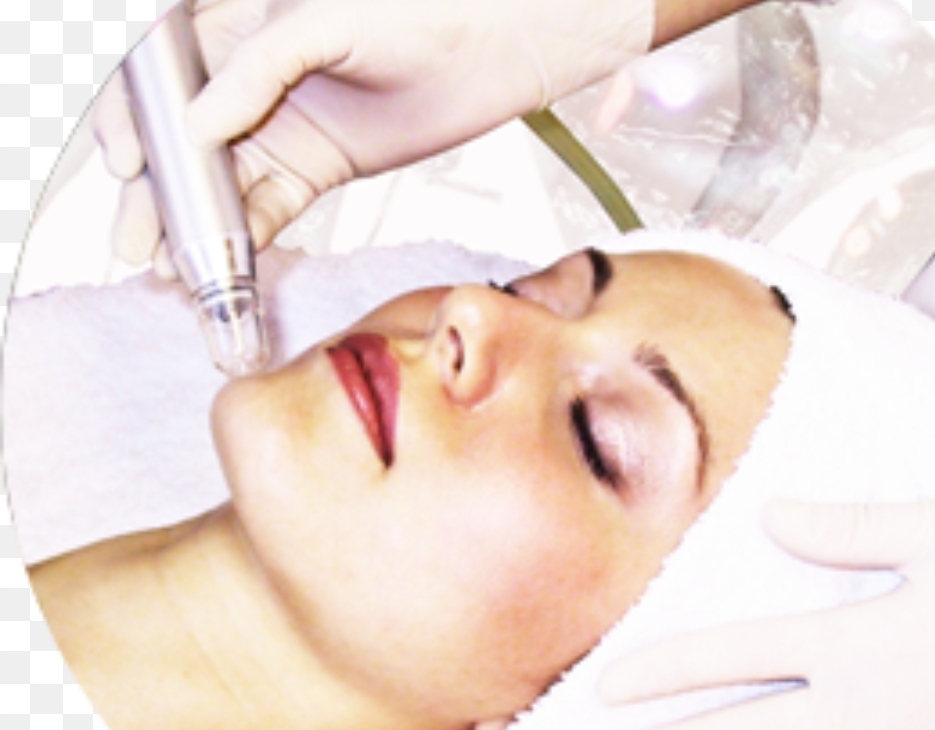 Hydrodermabrasion Facial