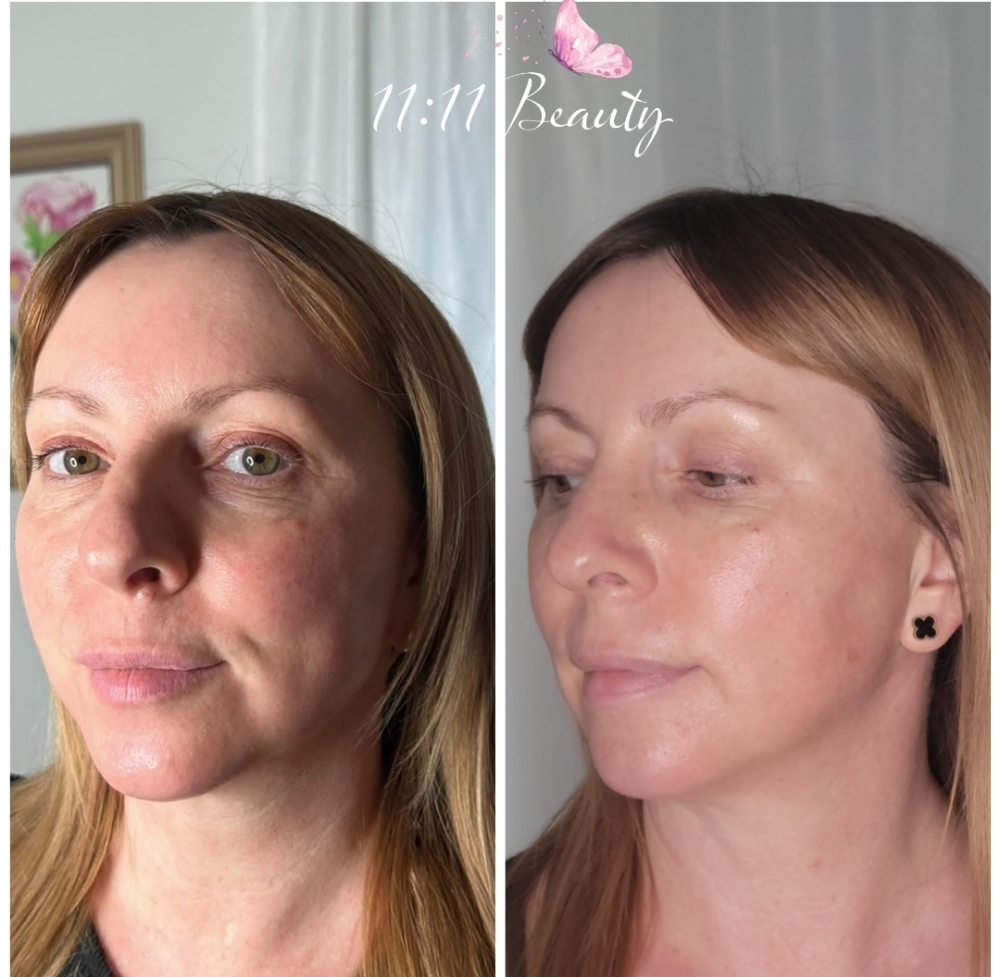 Jet Pasma Full Face Package Of 3