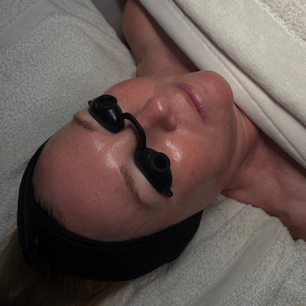 Diamond-Tip Microdermabraion Facial at NAKD SKN by Chloe in Kennmore, NY