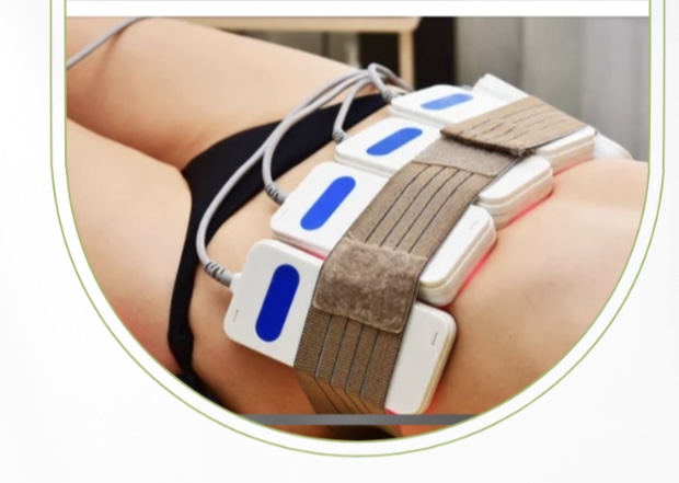 Laser Lipolysis