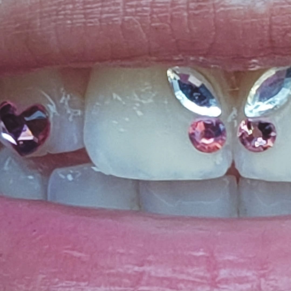 Tooth Gems
