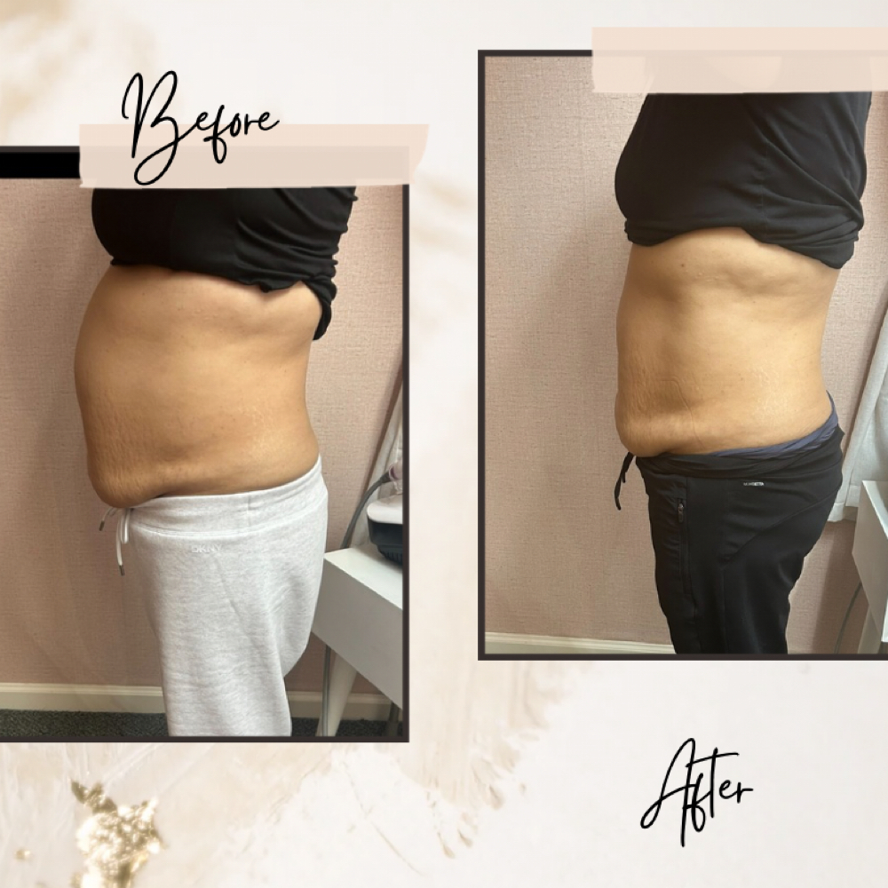 Contour and Confidence at Her Contour & Wellness, LLC in Antioch, CA