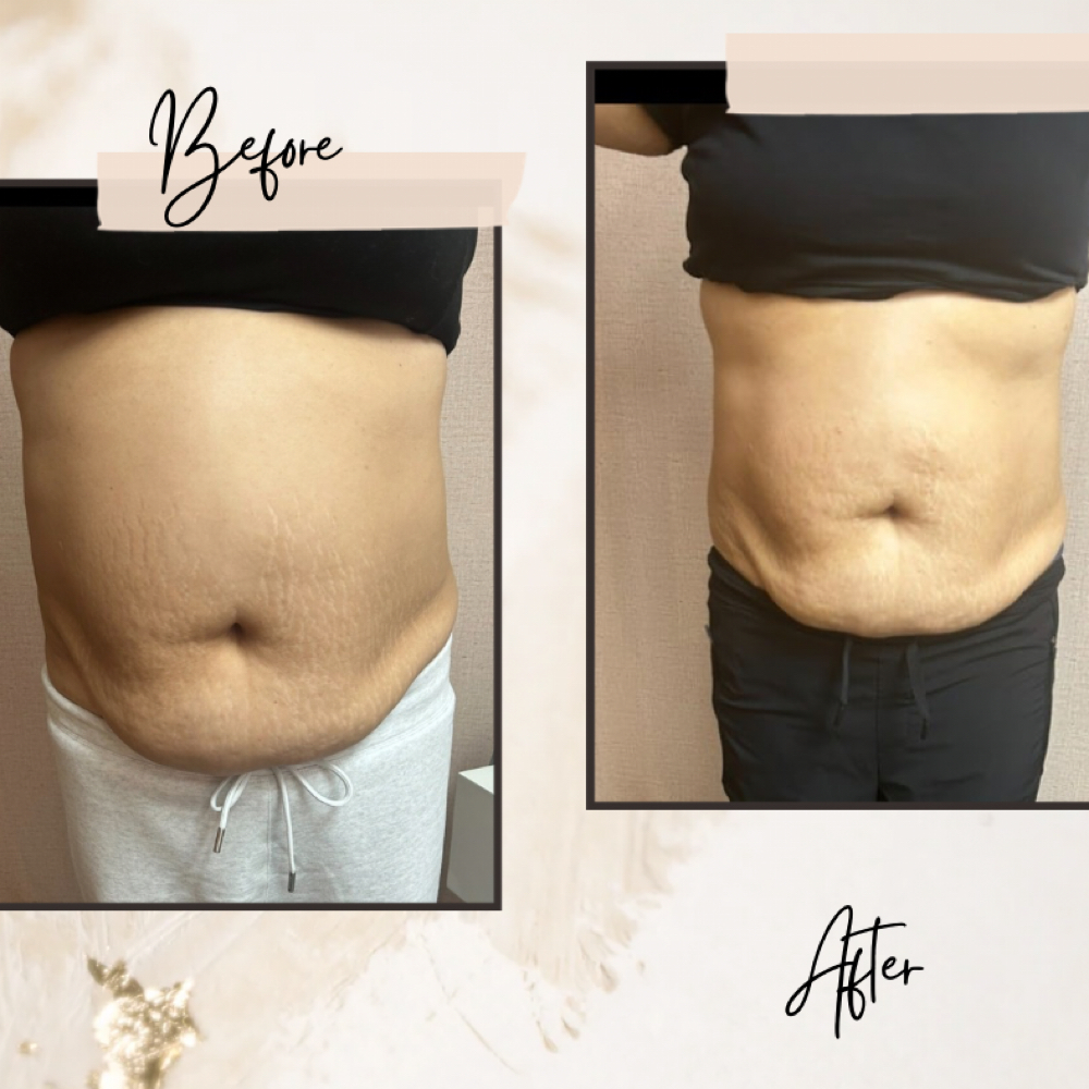 Contour and Confidence at Her Contour & Wellness, LLC in Antioch, CA