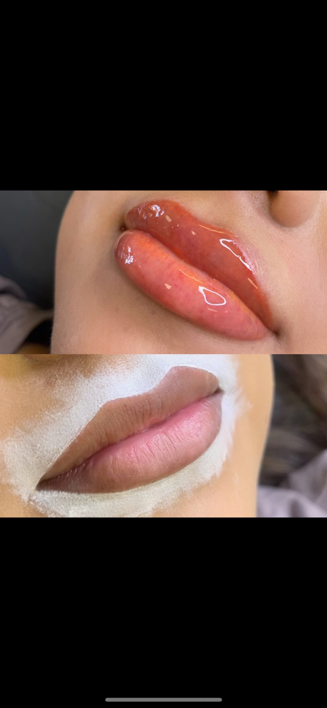 Lip Neutralization