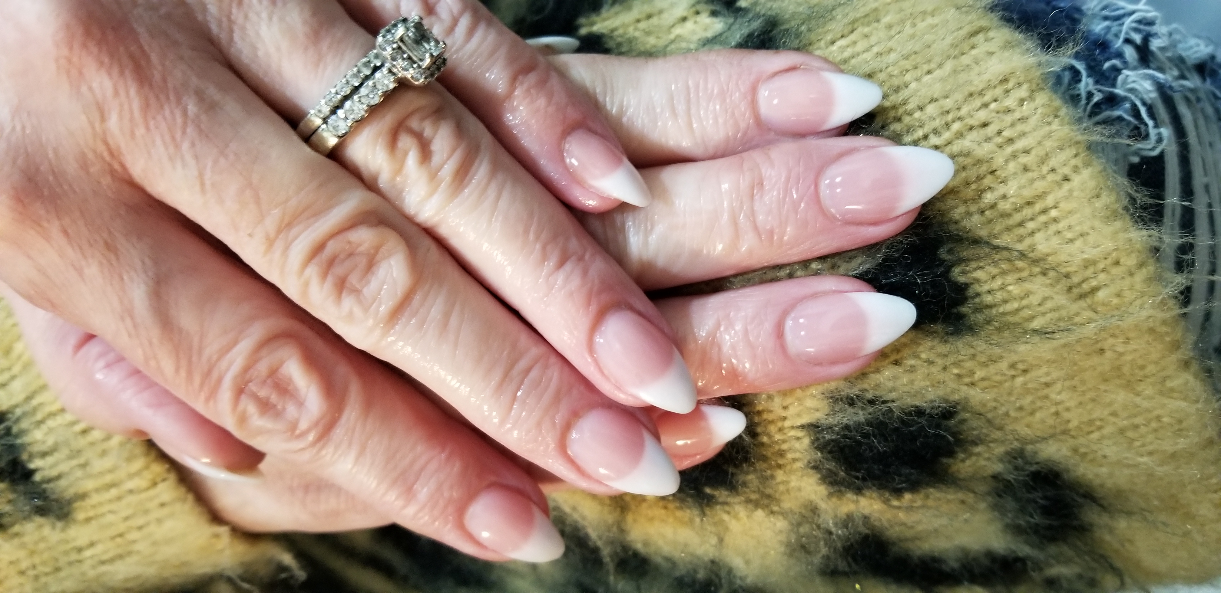 Pink And Whites (Acrylic Fill In)
