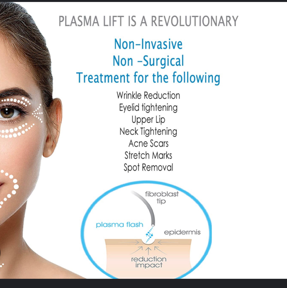 FIBROBLAST FACE LIFT