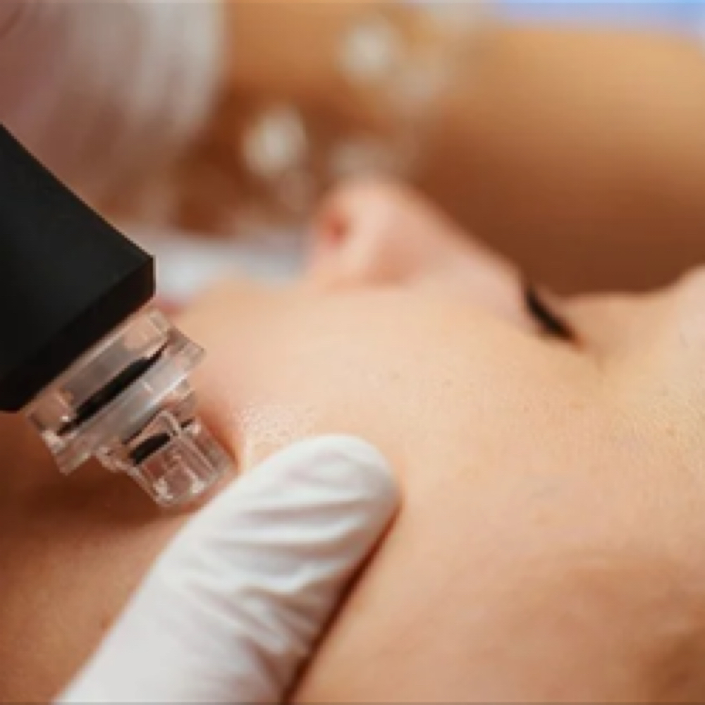 HYDRODERM FACIAL at Southern Touch Skin Studio in Conyers, GA