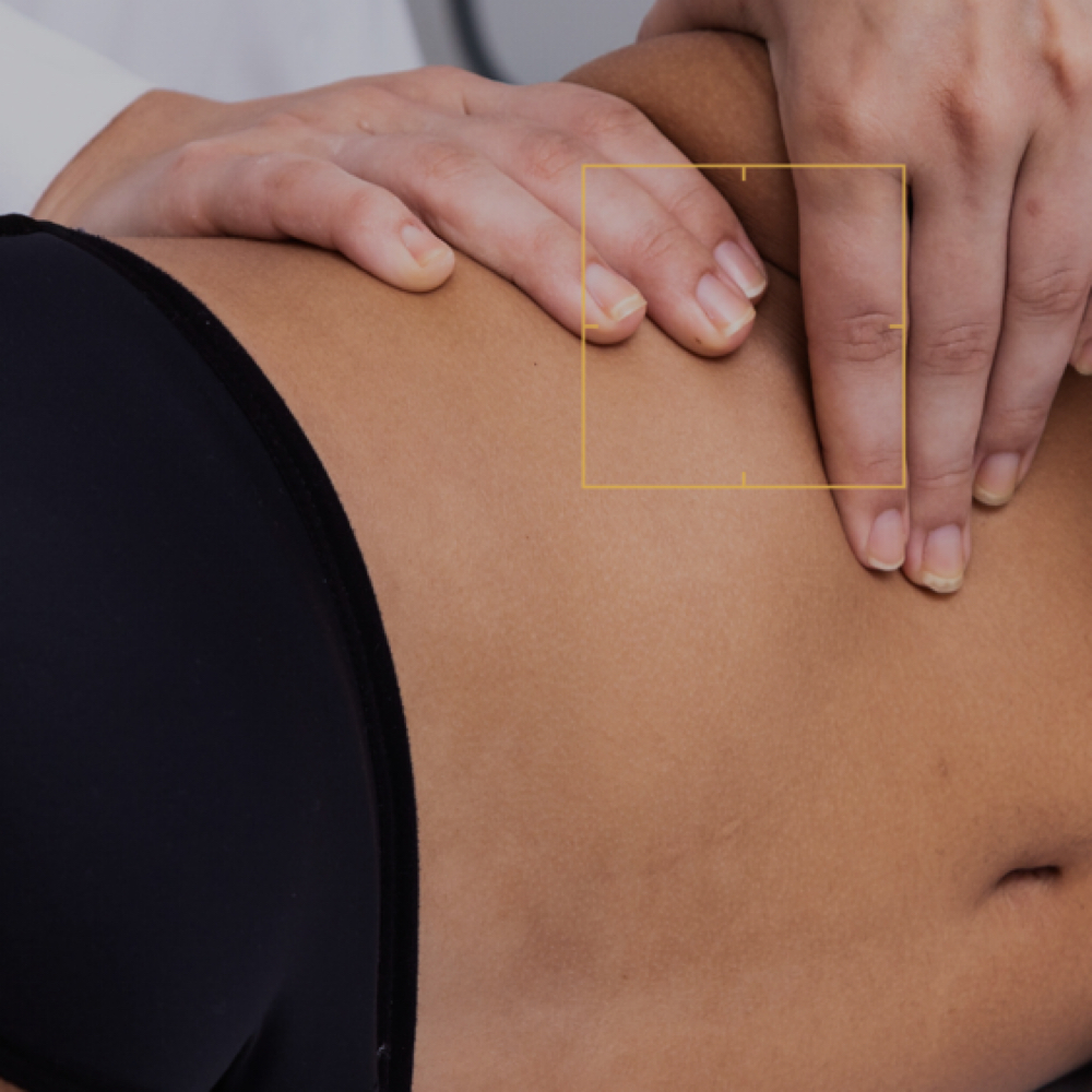 Post-Op Consult Lymphatic Drainage at Ivyleigh Wellness in Pikesville, MD