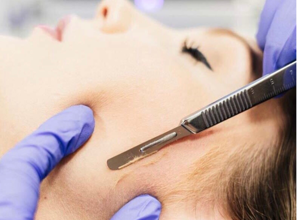 Dermaplane Facial - Current Clients