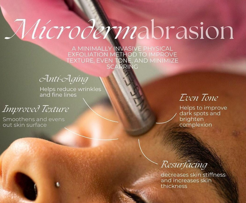 Diamond Microdermabrasion