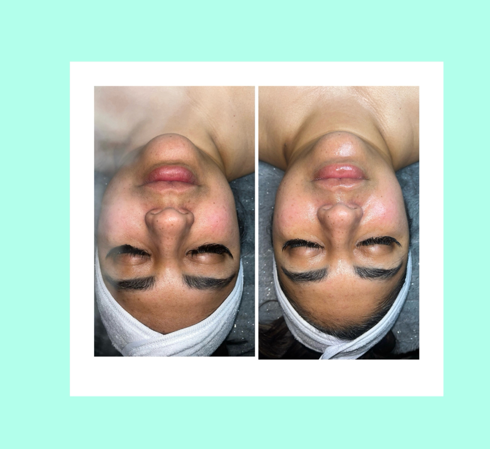 Express Signature Facial/Glow Club at Kohinoor Aesthetics By Marissa Elizabeth in San Antonio, TX