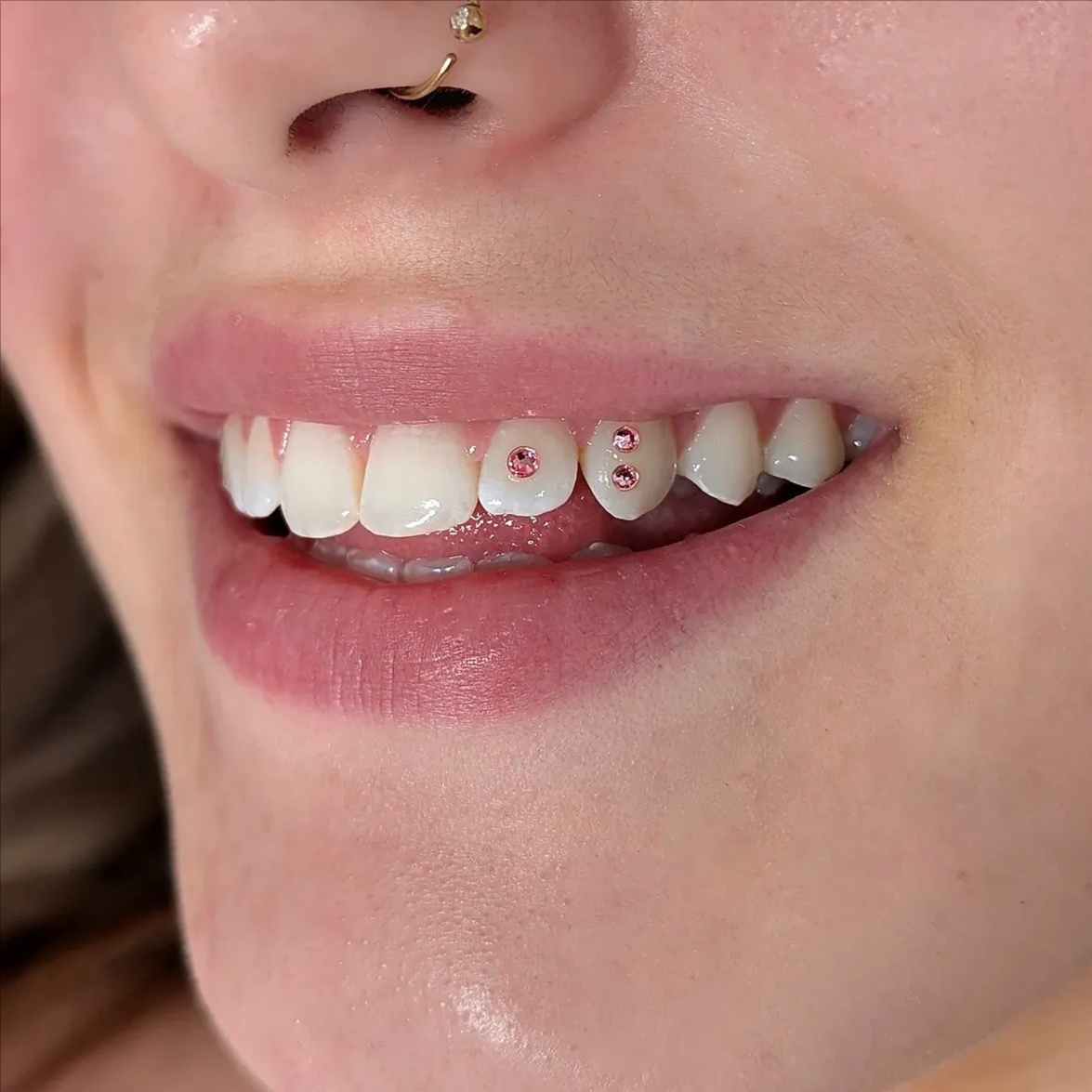 3 Tooth Gems (Swarovski Crystals) at Royal Blanc Smiles - Teeth Whitening and Tooth Gems in Charlotte, NC in Charlotte, NC