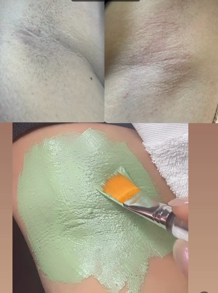 Underarm Waxing + Hydration