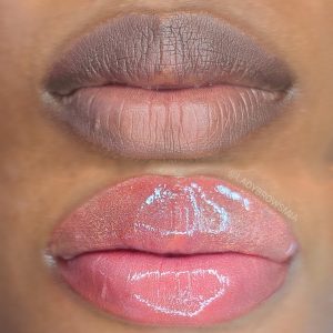 Dark Lips Correction