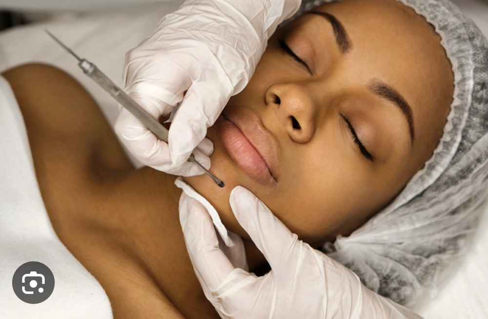 Add On Extractions For Facials