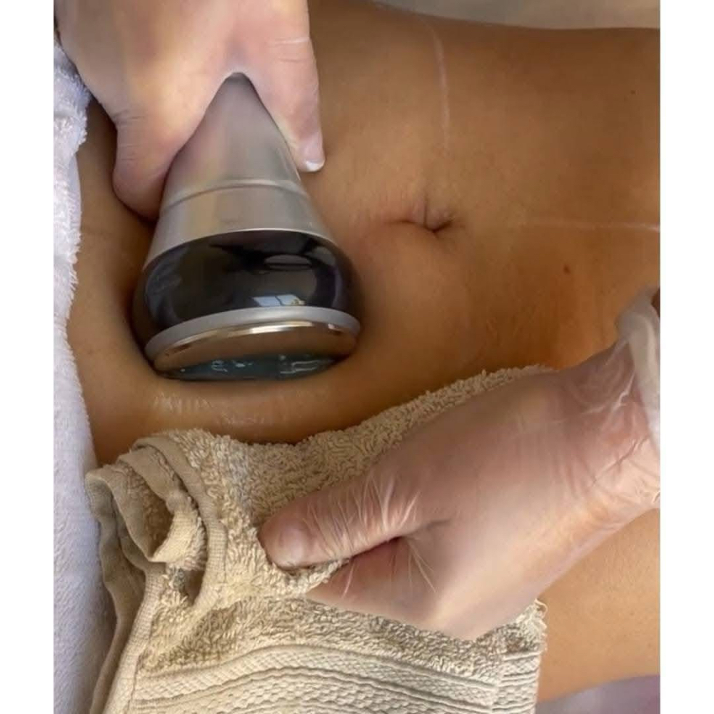 Body Contourning Individual Session