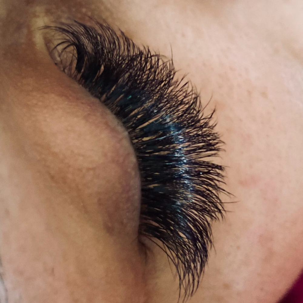 Fill: 3-week Volume at S.T. Esthetics in Michigan City, IN