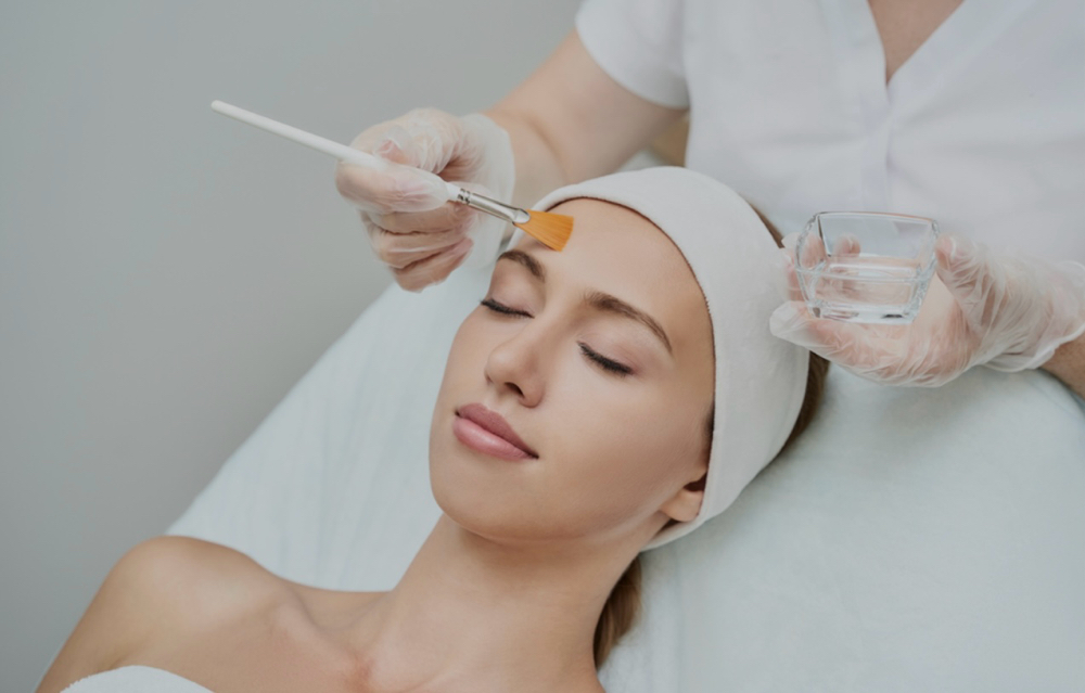 Chemical Peel