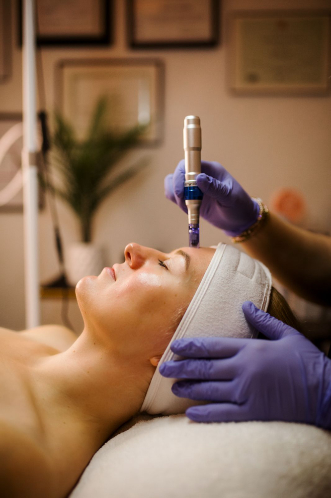 Microneedling