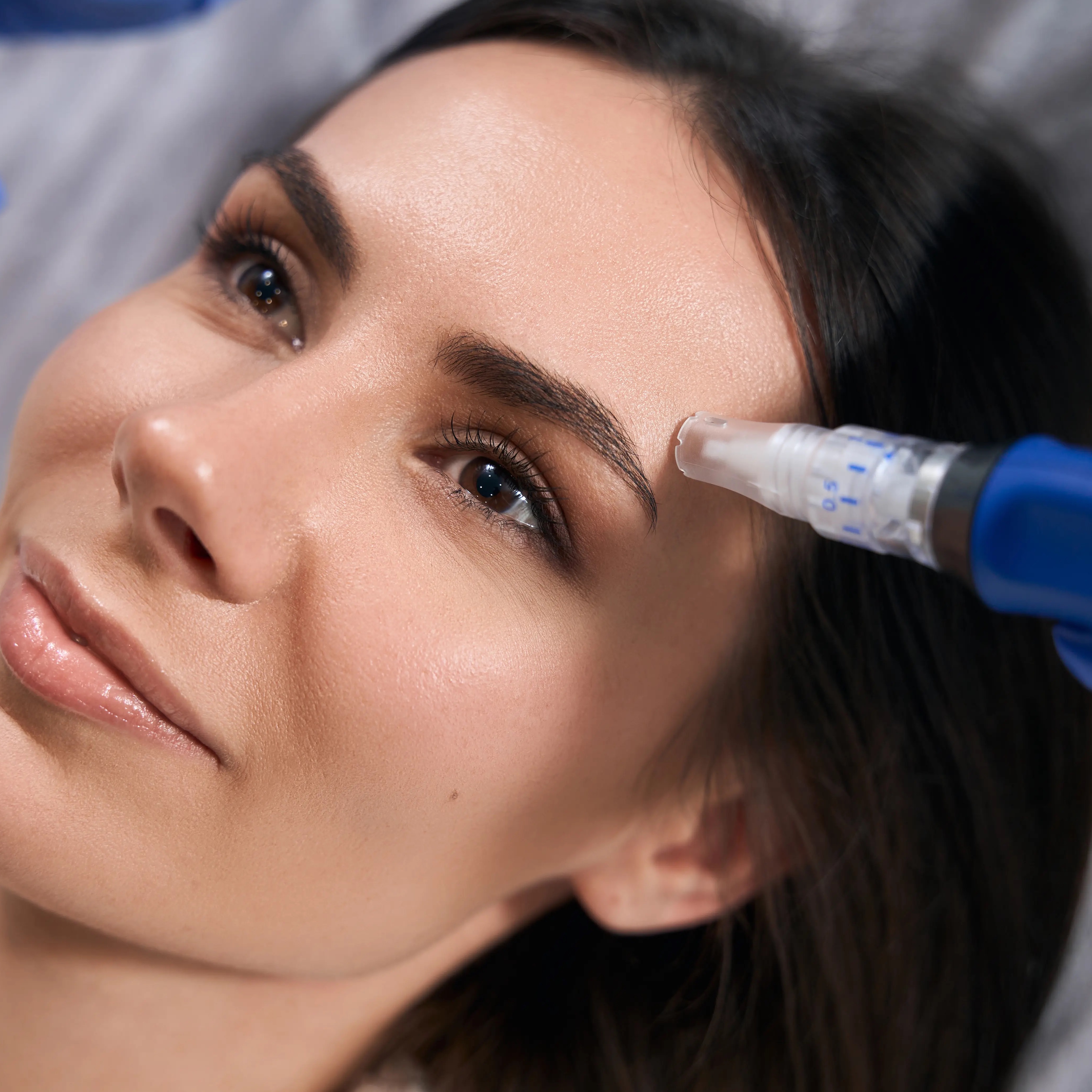 Rejuvapen Microneedling - Face at Katie Rose Aesthetics in Coeur D Alene, ID