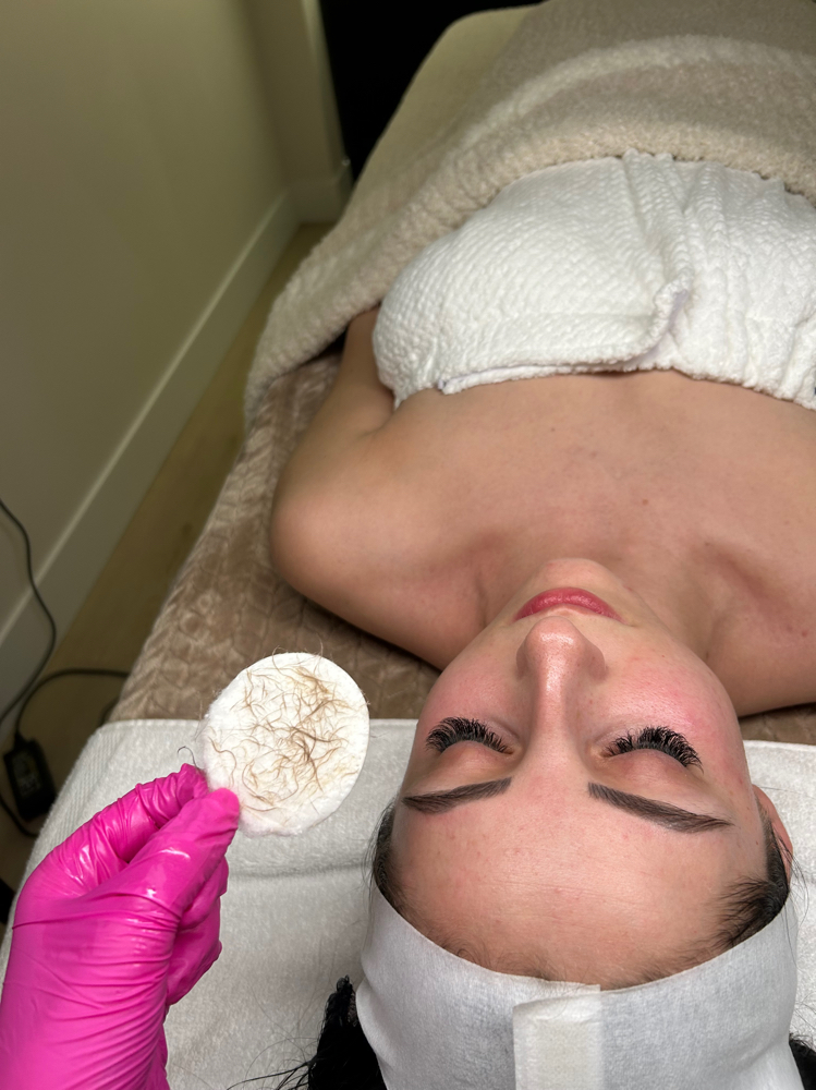 Dermaplane