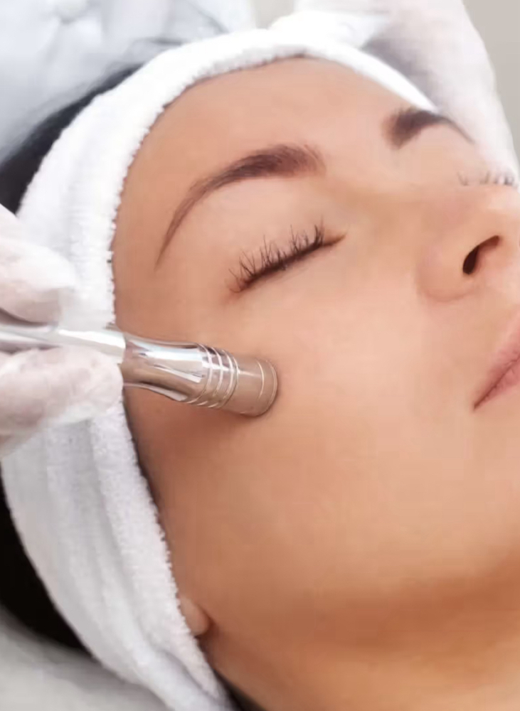 Microdermabasion Facial