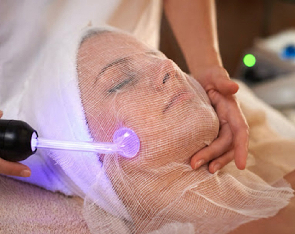 Acne Facial at Ashhsthetics in Southbury, CT