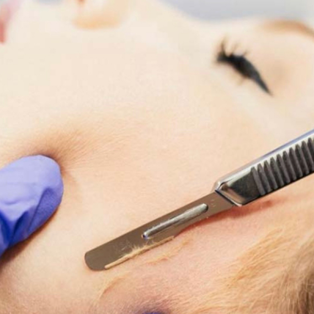 Dermaplane at Glamorous Beauty By Alisha Woodson in Jonesboro, AR