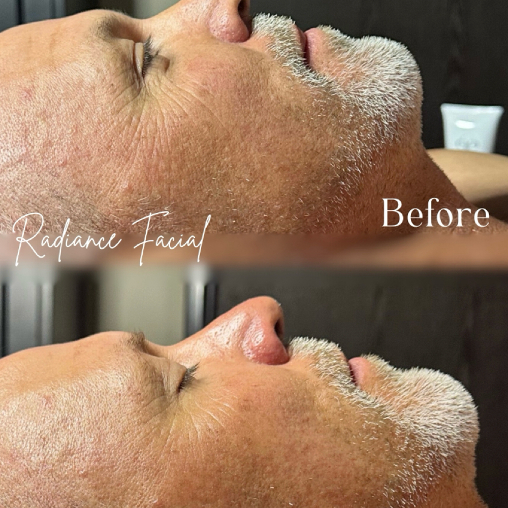 Radiance Facial at Lash & Wax Factory in Denver, CO