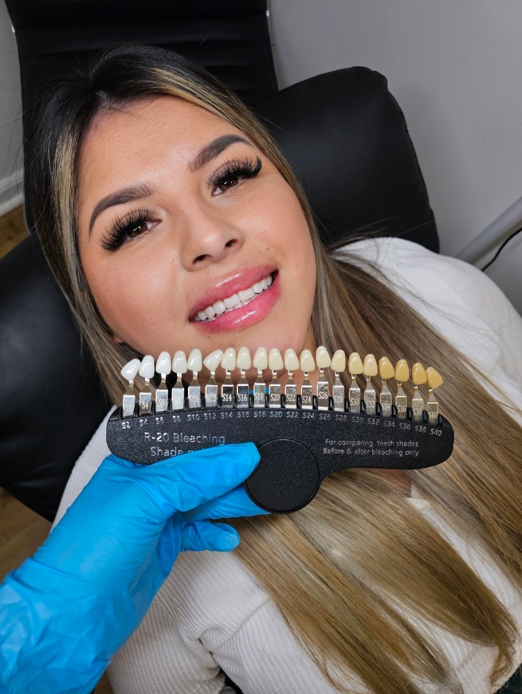 Teeth Whitening at Lux Aesthetics in Rockford, IL