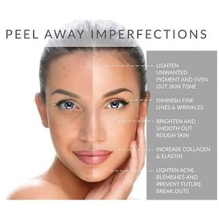 Illuminize Peel By SkinMedica