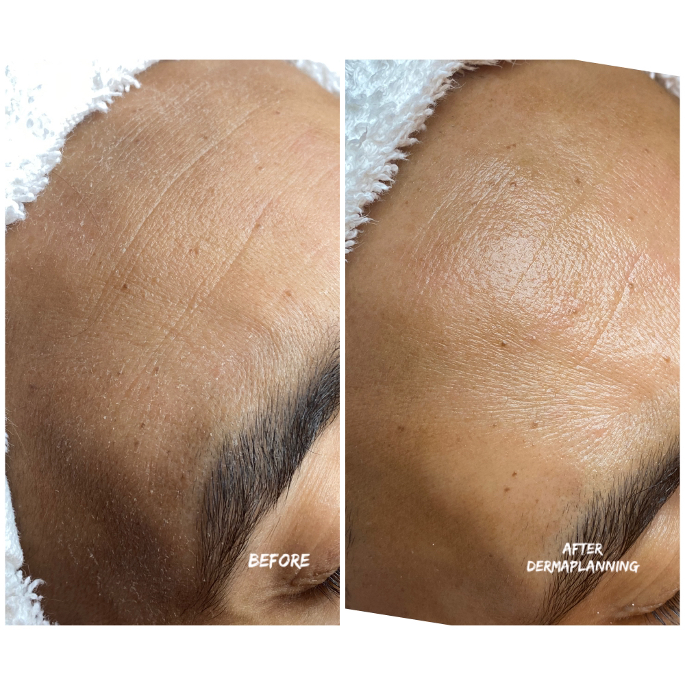 Dermaplane VIP Facial