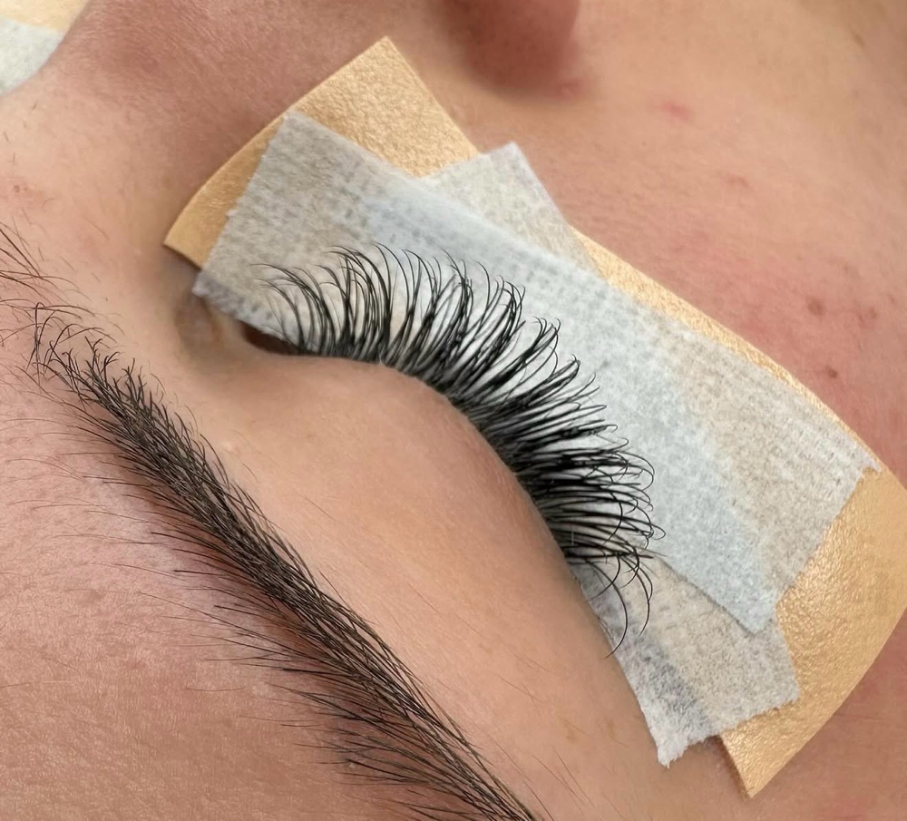 Classic Fill at Lace Esthetics in Chino Valley, AZ