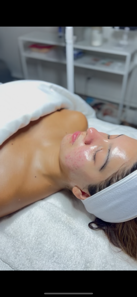 K-Glass Glow Facial at Sweet Touch Skin in Manassas, VA