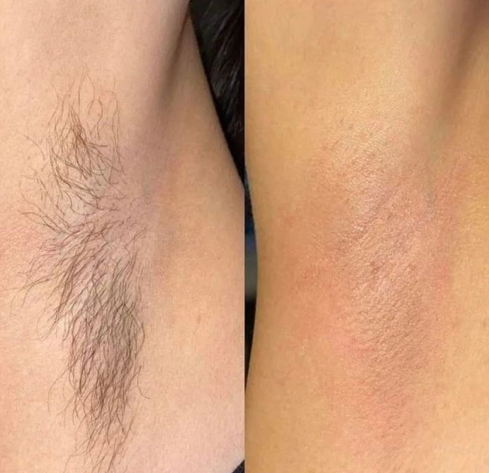 Armpit Wax