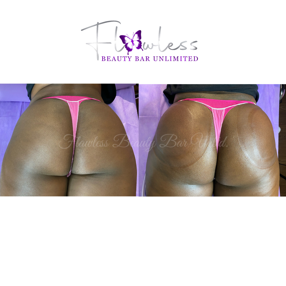 Body Sculpting Course