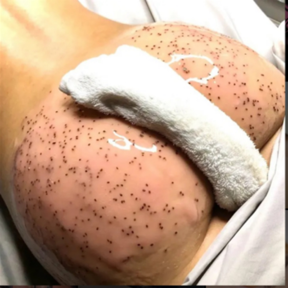 ✨Bum 🍑 Facial✨ at Nena’s Beauty Glow Bar in North Las Vegas, NV