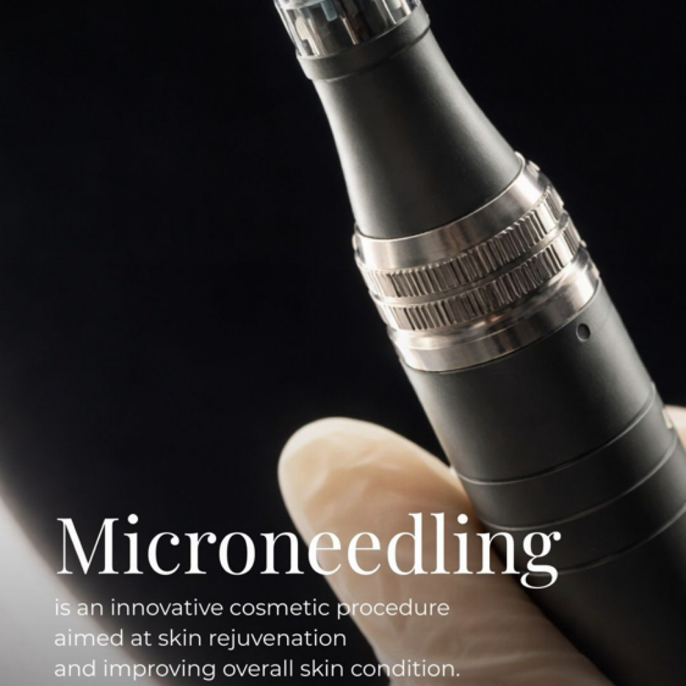 Microneedling at CP Aesthetics in Dallas, TX