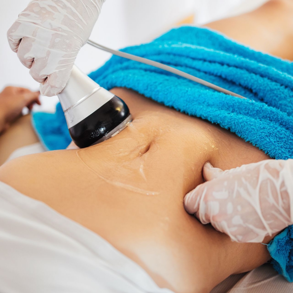 Body Contouring Treatment