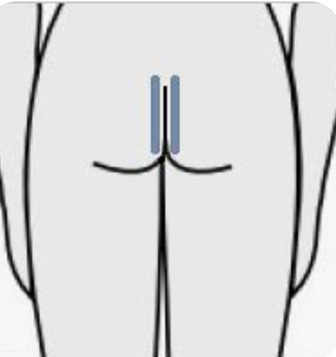 Butt Strip