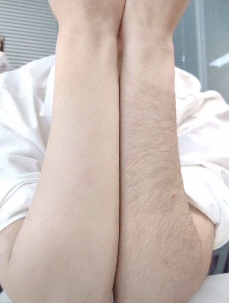 Arms (half)