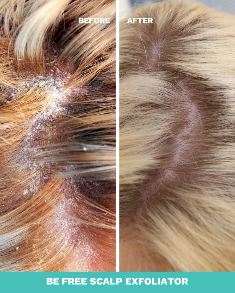 Malibu Crystal Gel Treatment