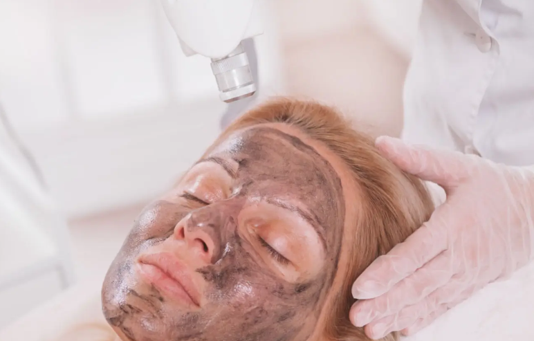 Carbon Hollywood Facial