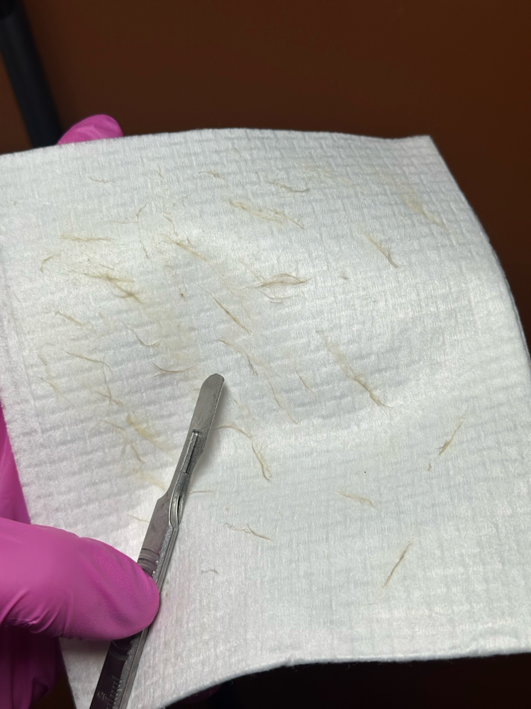 Dermaplaning at EstheticsByBella in Chillicothe, OH