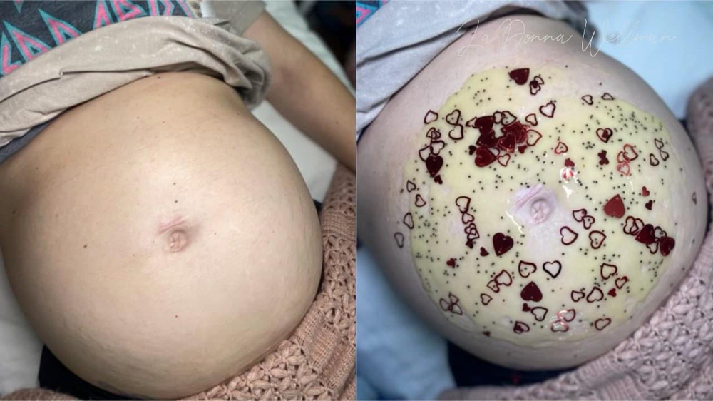 Prenatal Belly Mask at Southern Tease Salon & Spa in Leesville, LA