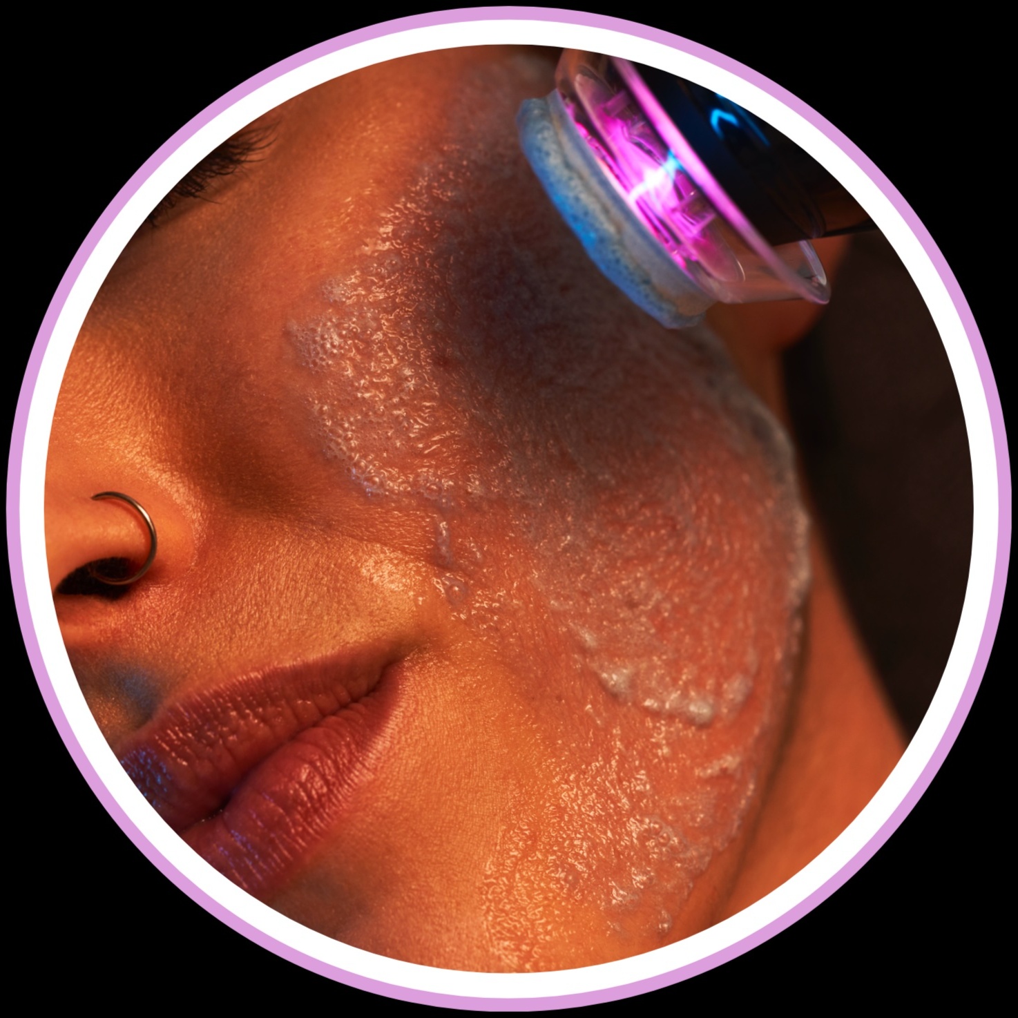 Glo2Facial /RadioFrequency -HYDRATE at FaceMe Skin Care in Bloomingdale, IL
